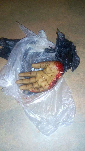  Graphic: Man had his hand chopped off by notorious 