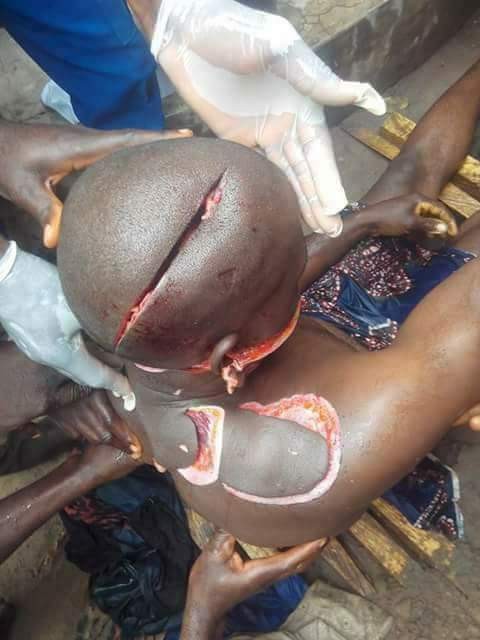 Very graphic photos: Man brutally hacked to death by unknown assailants in Nasarawa State