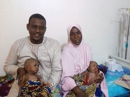 Photos: Federal Medical Center,?Yola successfully separates conjoined female twins