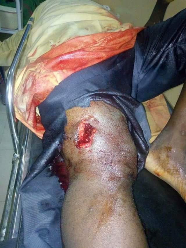  Photos: Trigger-happy Customs officer allegedly shoot driver during heated argument over fee at checkpoint in Bauchi