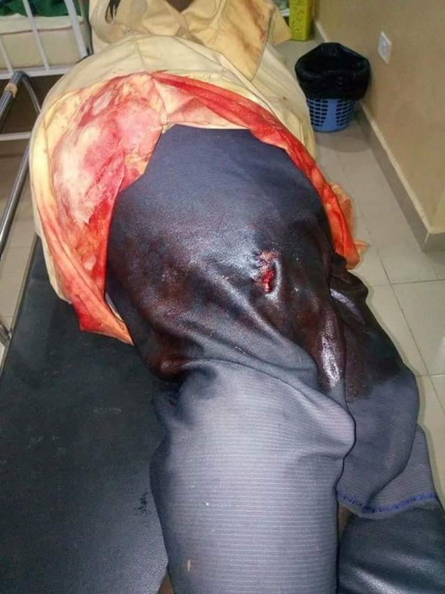  Photos: Trigger-happy Customs officer allegedly shoot driver during heated argument over fee at checkpoint in Bauchi