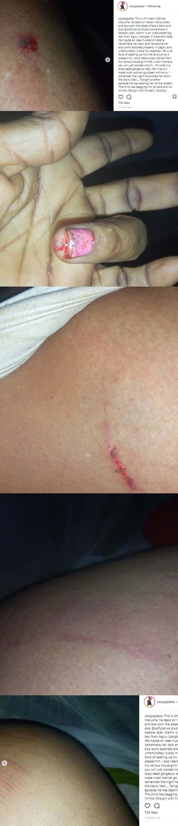 Cossy Orjiakor allegedly battered by her neighbour for interfering while he was beating his wife (photos)