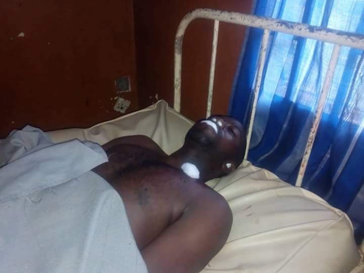 Graphic: APC agent stabbed in Osun election dies