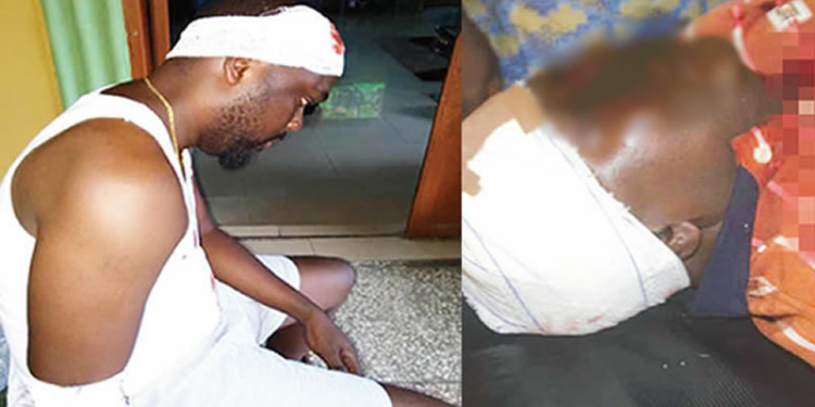 Victims of violence durng Lagos APC Primaries in Kosofe LGA