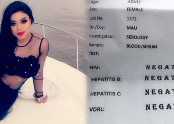 Bobrisky shares result of his HIV test