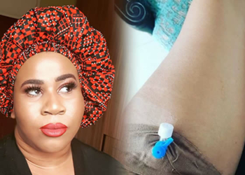 Comedienne Chigul discloses her anguish with an undisclosed ailment