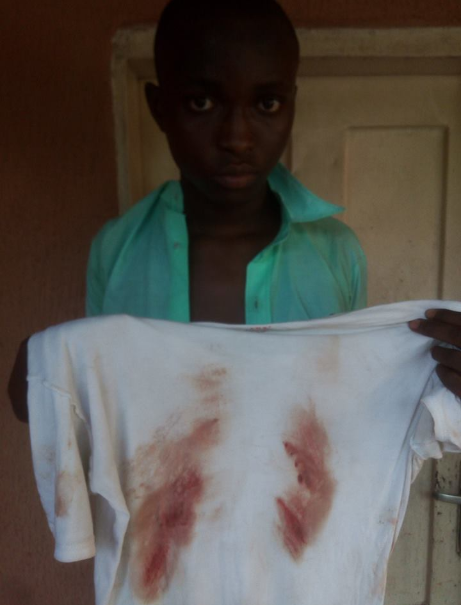 Soldiers batter schoolboy, 15, until he bled through his clothes because he did not wear the complete school uniform (photos)