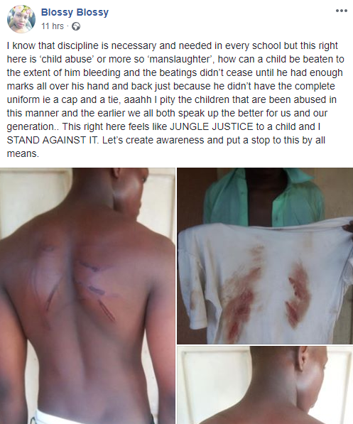 Soldiers batter schoolboy, 15, until he bled through his clothes because he did not wear the complete school uniform (photos)