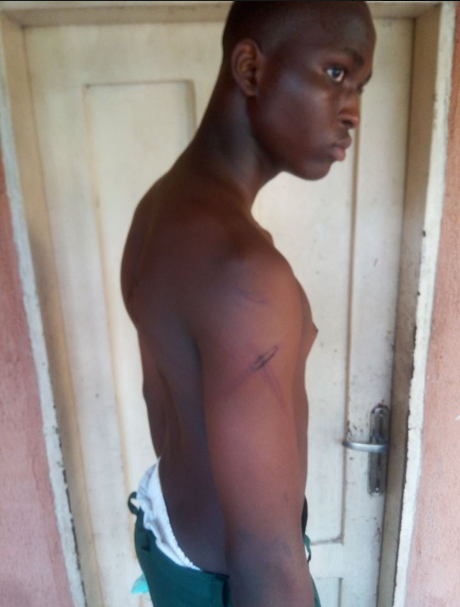 Soldiers batter schoolboy, 15, until he bled through his clothes because he did not wear the complete school uniform (photos)