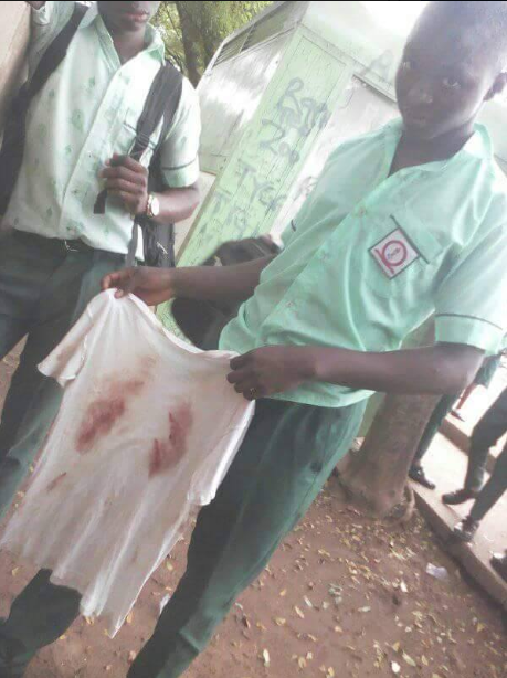 Soldiers batter schoolboy, 15, until he bled through his clothes because he did not wear the complete school uniform (photos)