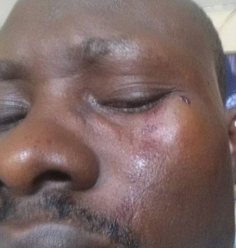Taxify driver claims he was battered by 