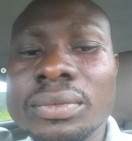 Taxify driver claims he was battered by 