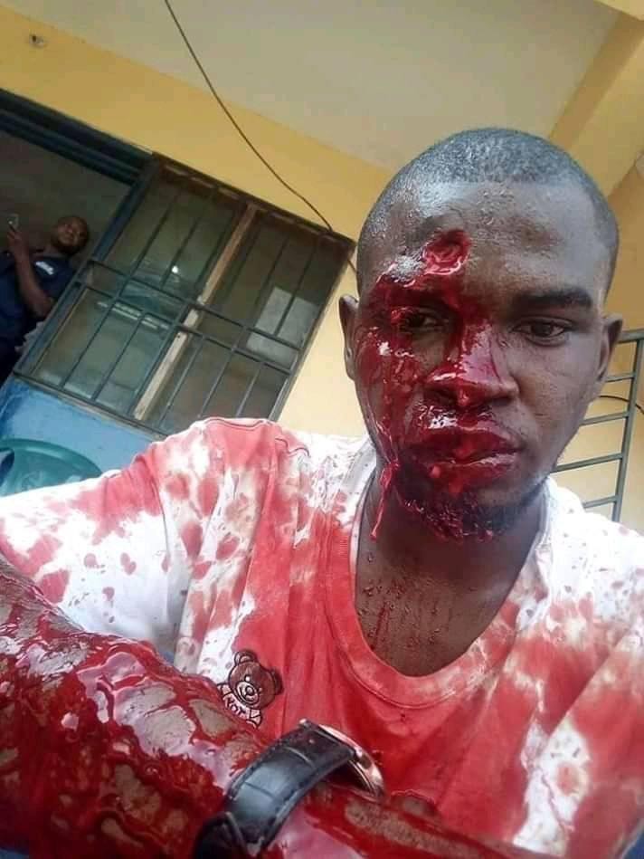 Blood flows as fight breaks out in a popular Nigerian bar in Ghana (graphic photo)
