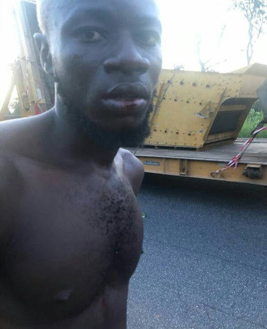 Photos: Nigeria Amputee Football Team involved in auto crash en-route Abuja for visa appointment