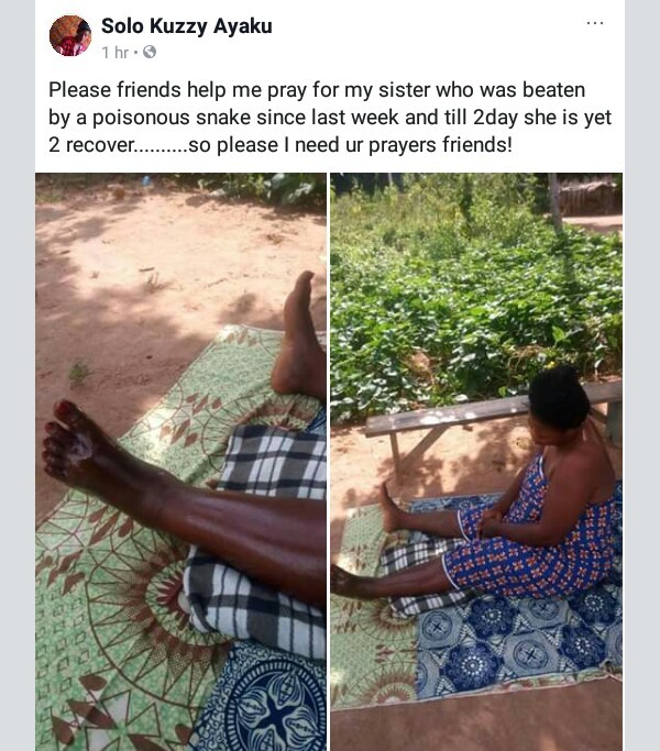 Photos: Nigerian woman battles for life days after being bitten by poisonous snake
