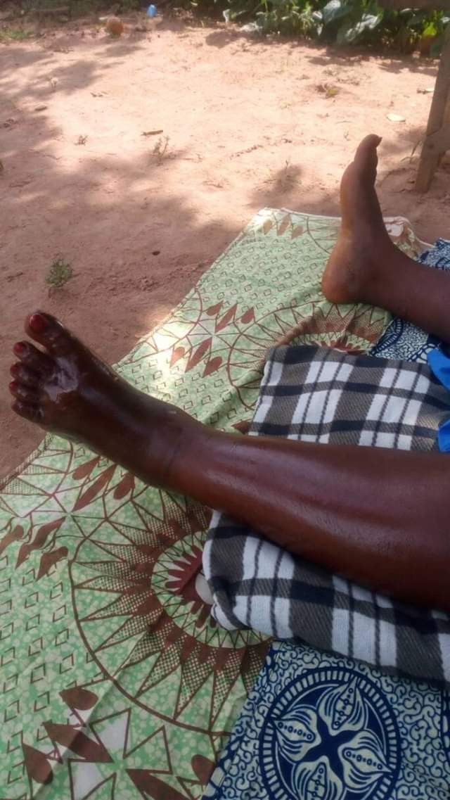 Photos: Nigerian woman battles for life days after being bitten by poisonous snake