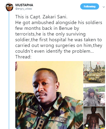 Photos: Nigerian soldier in critical condition after hospital carries out wrong surgery on him 