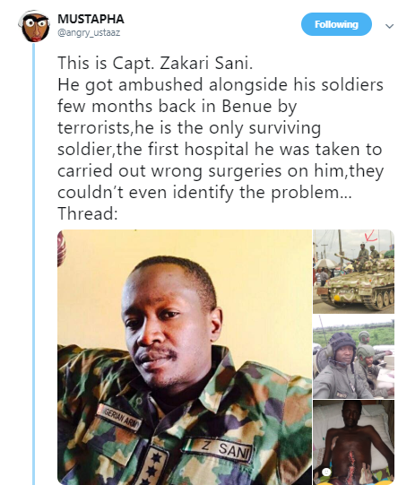 Photos: Nigerian soldier in critical condition after hospital carries out wrong surgery on him