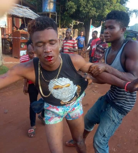 Young man killed by mob after he and his accomplice were allegedly caught stealing iPhone 6 and laptop (graphic video/photos)