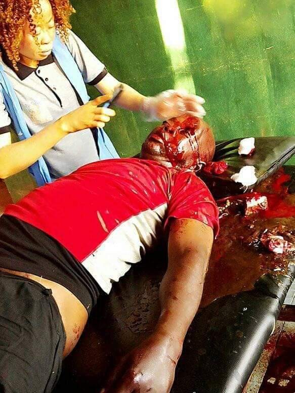 Graphic: Help needed to identify victim of fatal accident in Enugu