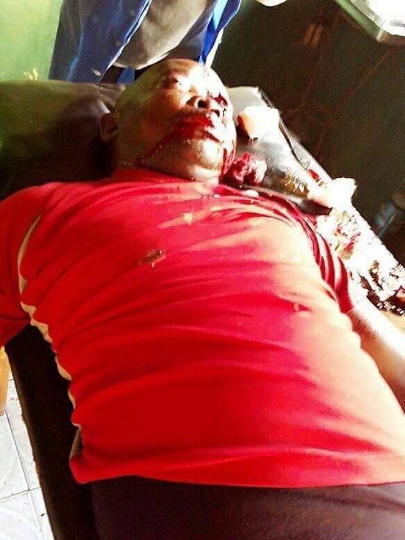 Graphic: Help needed to identify victim of fatal accident in Enugu