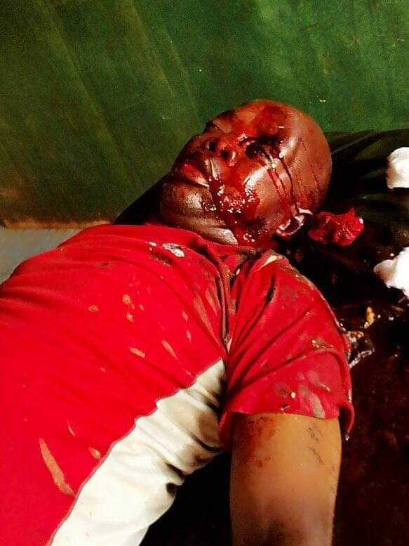 Graphic: Help needed to identify victim of fatal accident in Enugu