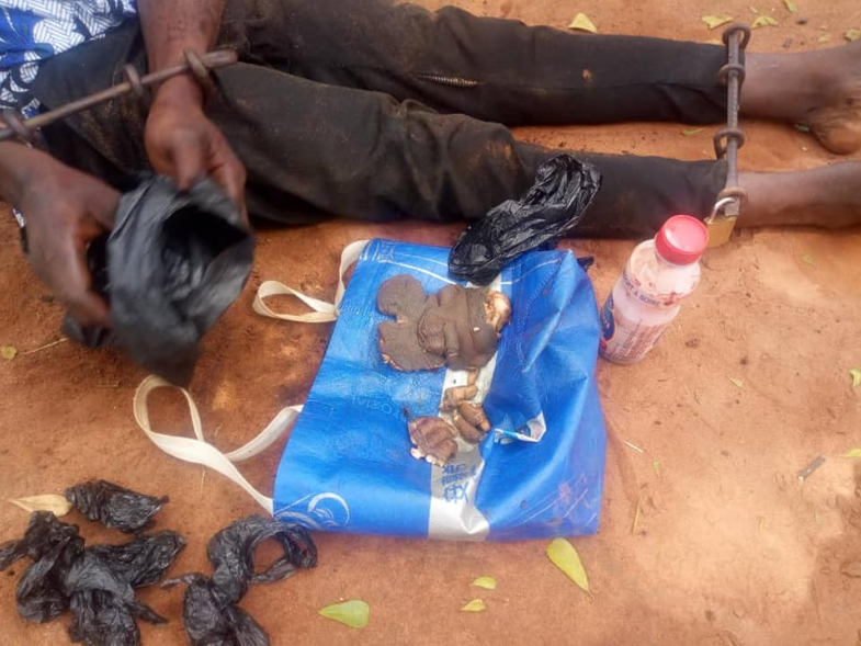 19-year-old man caught with genitals and other human parts in Awka (graphic photos)