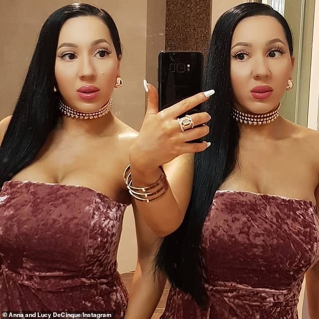 Meet the identical twin sisters who share the same boyfriend and just had a reversed operation after they spent $250k on cosmetic surgery (Photos)