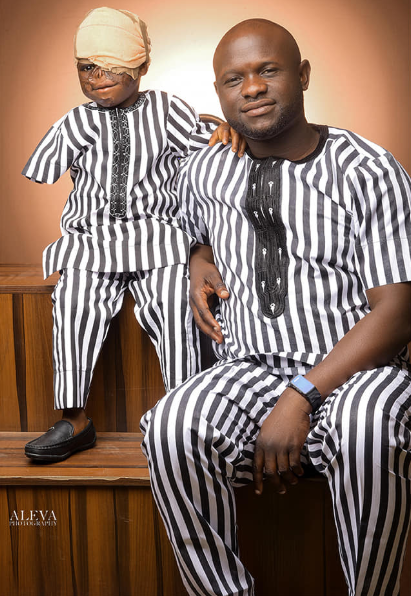 Young burn victim who lost his sight and arm in fire accident defies the odds to survive (photos)