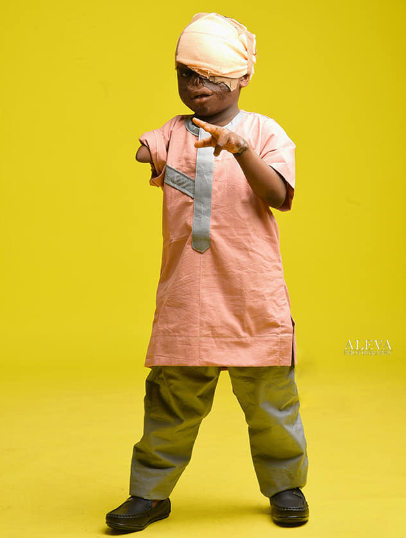 Young burn victim who lost his sight and arm in fire accident defies the odds to survive (photos)