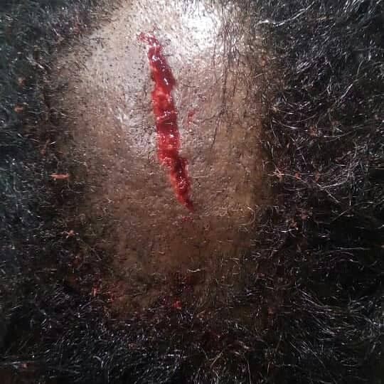 Photos: Man allegedly batters wife after she caught him cheating