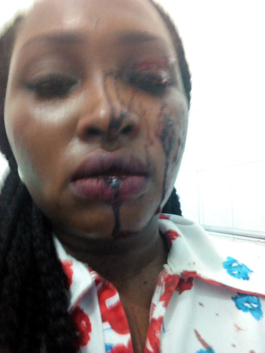 Lady who got robbed in Port Harcourt shares graphic photos from the attack