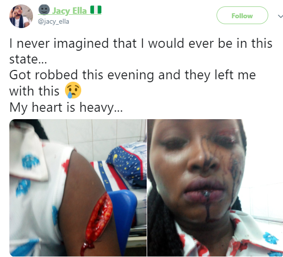 Lady who got robbed in Port Harcourt shares graphic photos from the attack