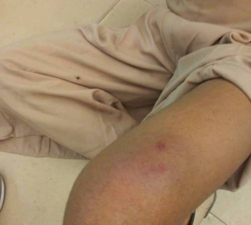 Many injured as members of the African Action Congress and the Nigeria Police clash during protest in Lagos(police)