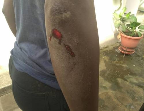 Many injured as members of the African Action Congress and the Nigeria Police clash during protest in Lagos(police)