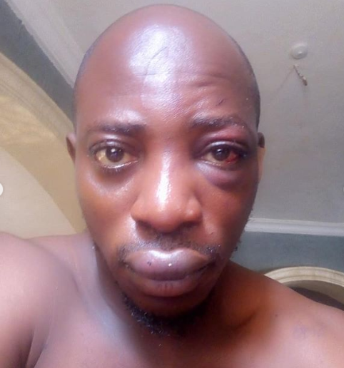 Nigerian gospel artist survives ritualist attack (photos)