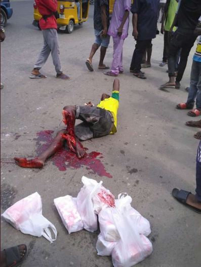 Man begs God to take his life as his leg is crushed in an accident in Ajah while selling bread to cater for his pregnant wife (graphic photos/video)