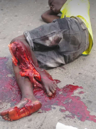 Man begs God to take his life as his leg is crushed in an accident in Ajah while selling bread to cater for his pregnant wife (graphic photos/video)