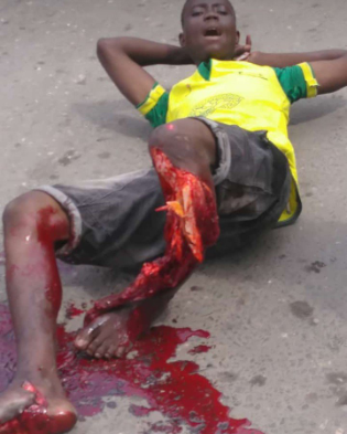Man begs God to take his life as his leg is crushed in an accident in Ajah while selling bread to cater for his pregnant wife (graphic photos/video)