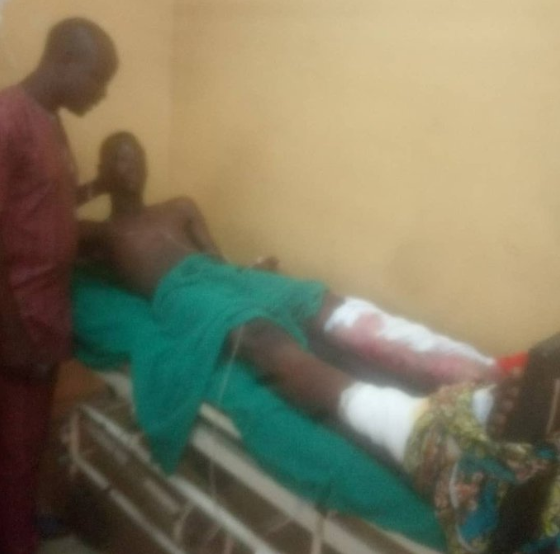 Man begs God to take his life as his leg is crushed in an accident in Ajah while selling bread to cater for his pregnant wife (graphic photos/video)