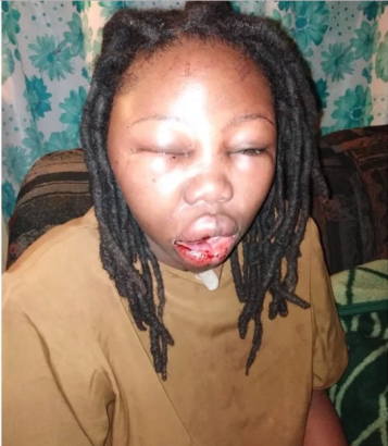 [Image: South-African-actress-beaten-by-boyfrien...57x410.png]