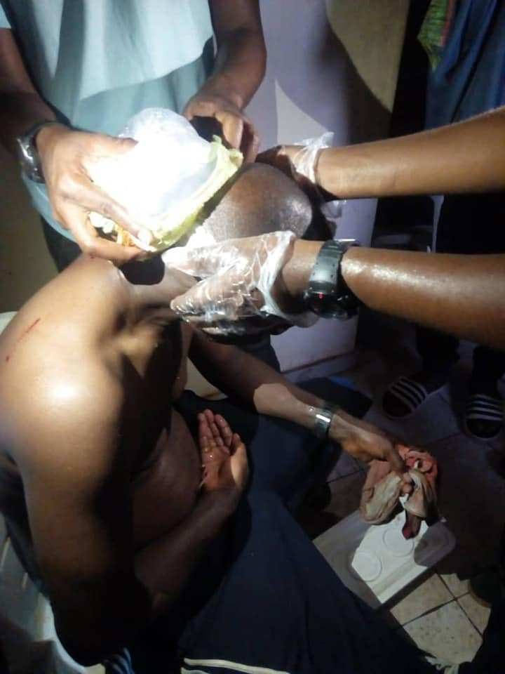 Remo Stars fan attacks, breaks referee?s head after match failed to end in the club