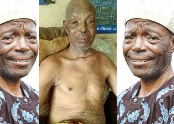 Veteran Yoruba Actor, Alabi Yellow, Dying Of Stroke