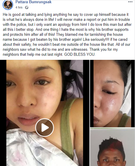 Thai woman accuses her Nigerian boyfriend of domestic violence as she shares photos of her injuries