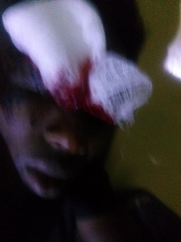Graphic: Cultists slash wrist of innocent man they thought was their rival in Jos