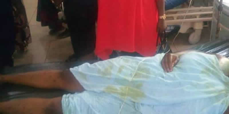 Man Bathes His Wife With Acid In Anambra