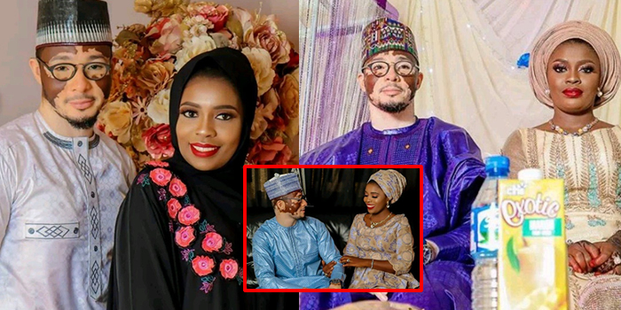 A Nigerian man who suffers from vitiligo got married to his heartthrob
