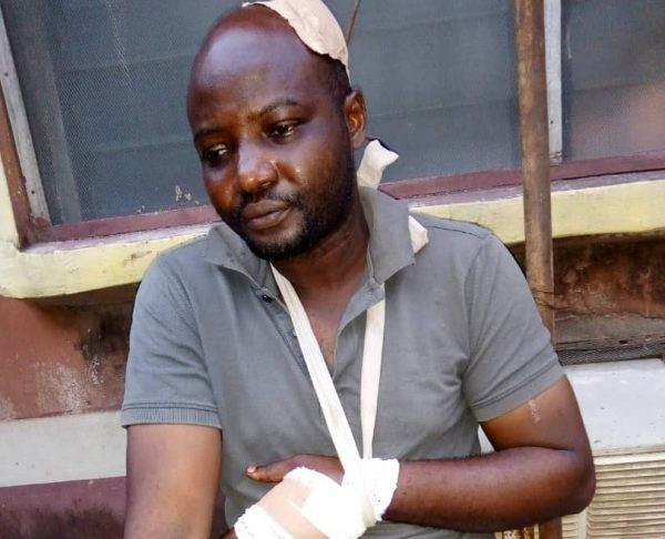 Photo Journalist attacked by armed robbers in Lagos (photos)