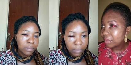 Update: Friend of lady accused of sending thugs to beat her husband to death in Port Harcourt gives her own account, says the man was a serial wife beater