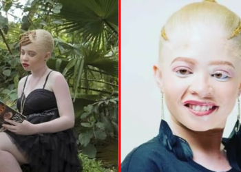 Ayanda Sibanda gets crowned as Miss Albinism Zimbabwe